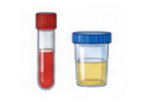 Blood and urine collection tubes representing common biological matrices